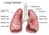 Cancer Images